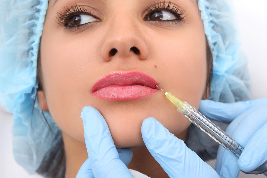 Lip Filler Injection